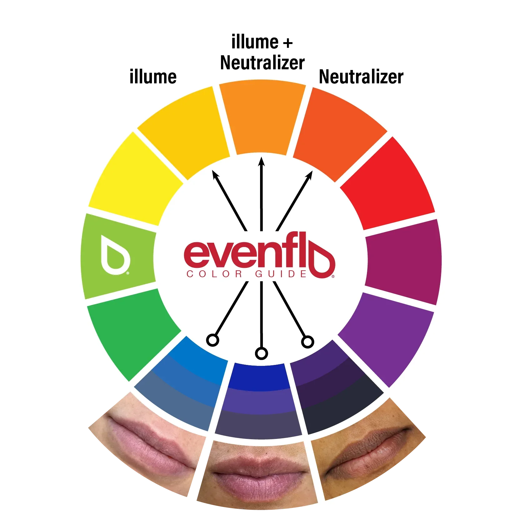 Evenflo Neutralizer Set — 3 1/2oz Bottles